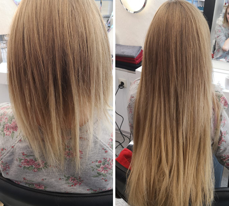 Extensions